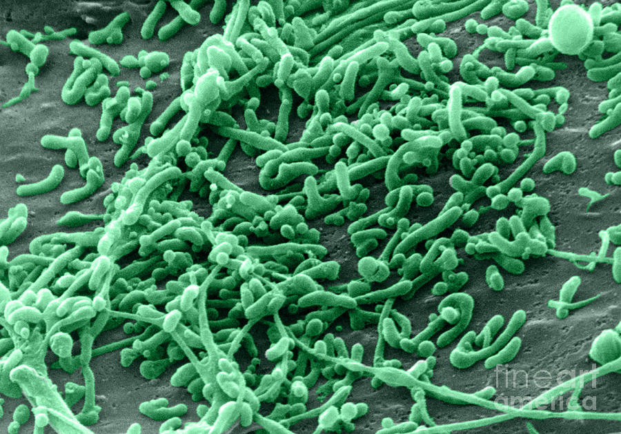 Bacterial Photograph - Mycoplasma Bacteria, Sem #1 by David M. Phillips