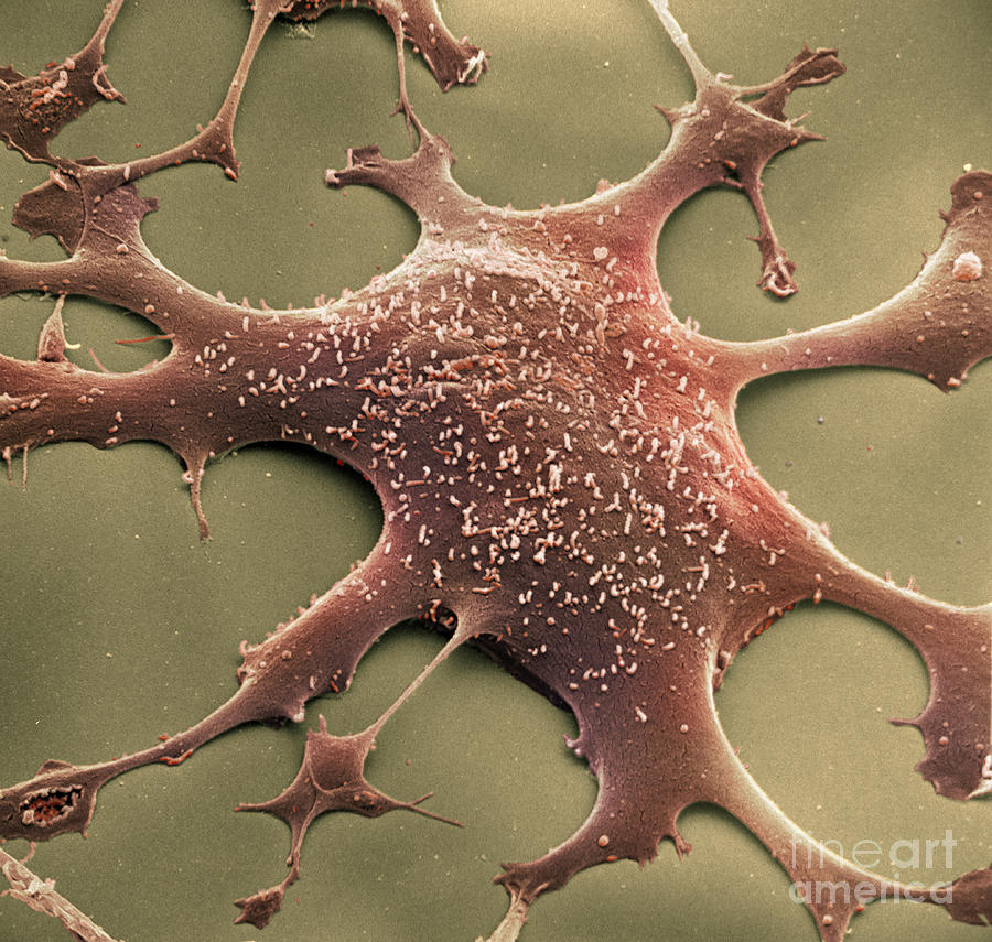 Fibroblast Photograph - Mycoplasma #1 by David M. Phillips