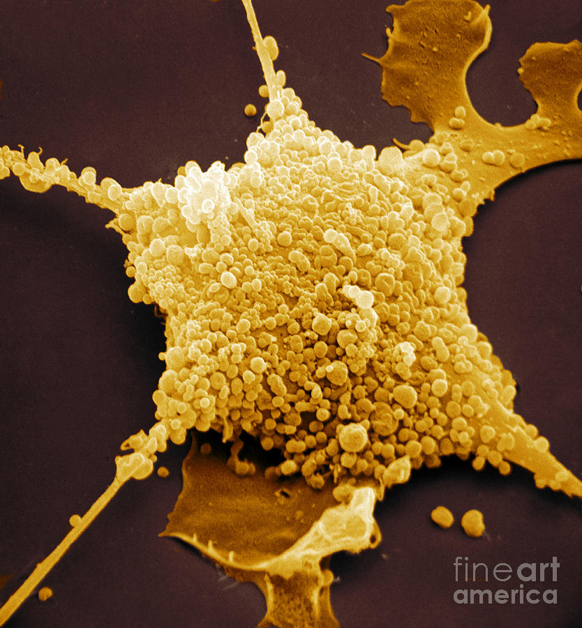 Mycoplasma, Sem #1 Photograph by David M. Phillips