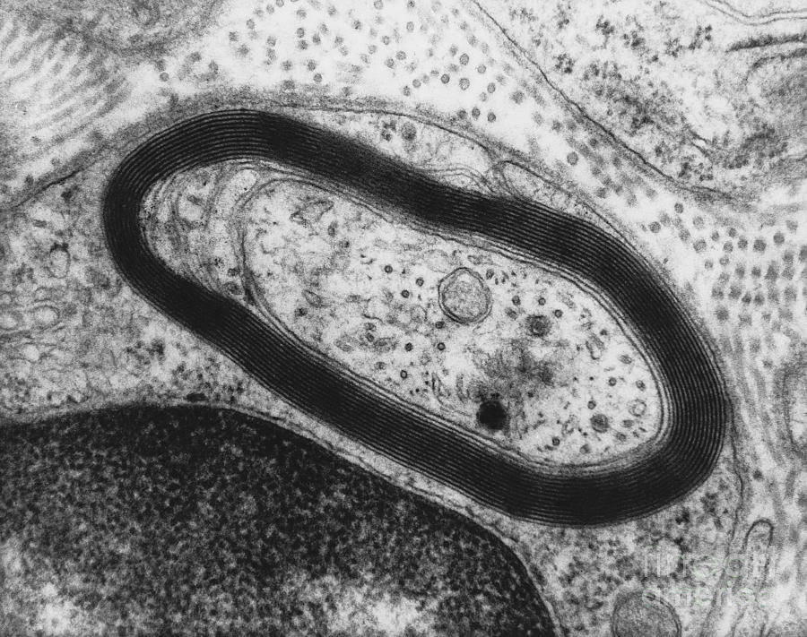 Myelinated Axon Tem #1 Photograph by David M. Phillips