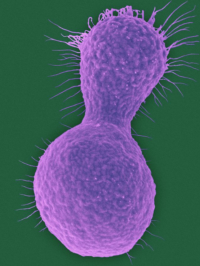 Myxozyma Mucilagina Ascomycetous Yeast #1 Photograph by Dennis Kunkel Microscopy/science Photo Library