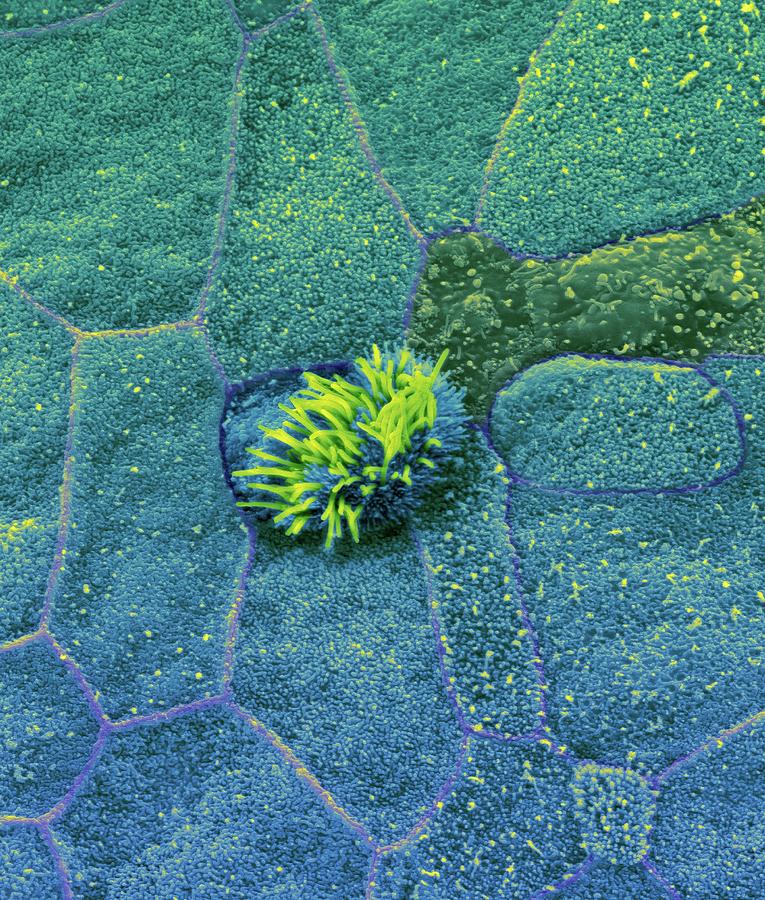 Nasopharynx Epithelial Surface #1 Photograph by Dennis Kunkel Microscopy/science Photo Library