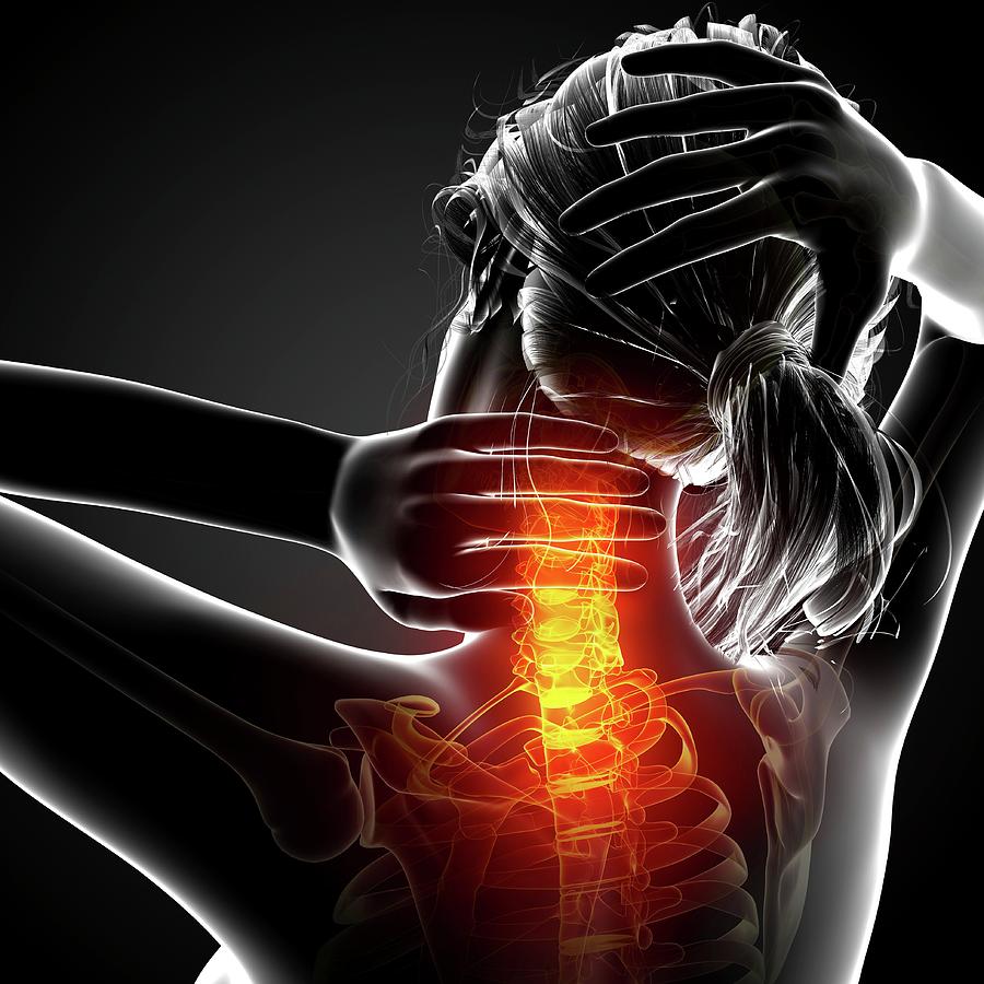 Neck Pain Photograph by Pixologicstudio/science Photo Library - Fine ...