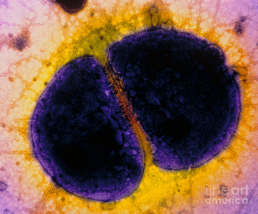Tem Photograph - Neisseria Gonorrhoeae #1 by Kwangshin Kim