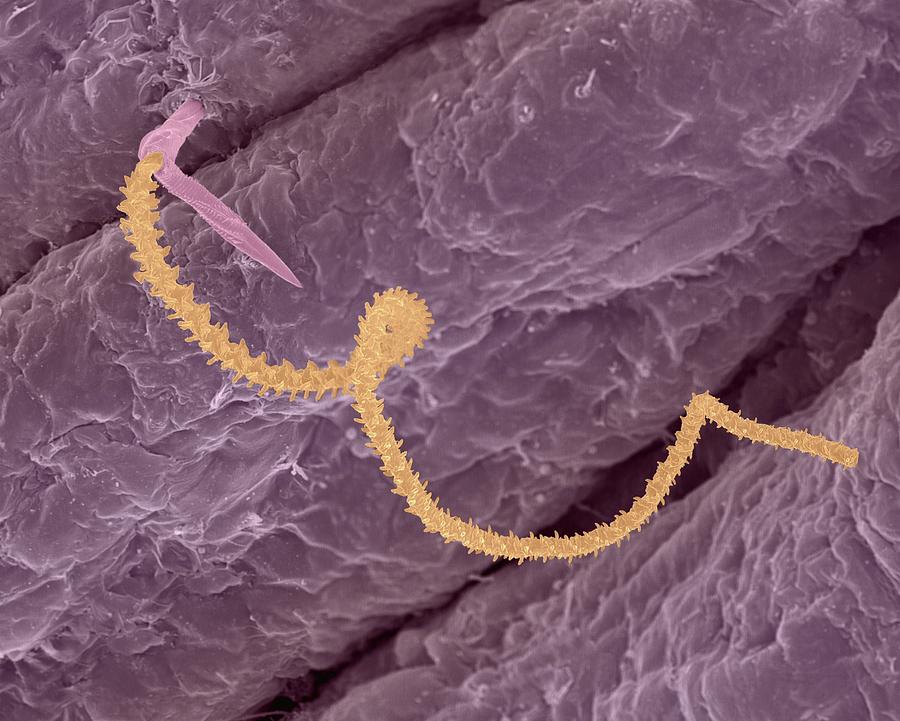 Nematocyst From Box Jellyfish (carybdea Alata) #1 Photograph by Dennis Kunkel Microscopy/science Photo Library
