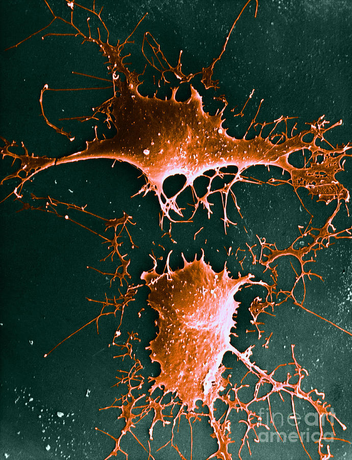 Nerve Cell, Sem #1 Photograph by David M. Phillips