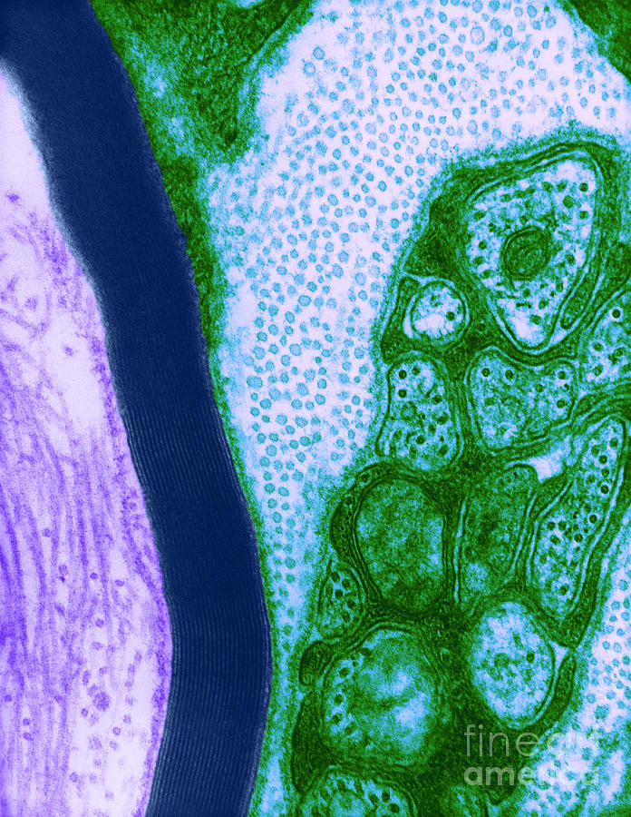 Microscopy Photograph - Nerve Cell, Tem #1 by David M. Phillips