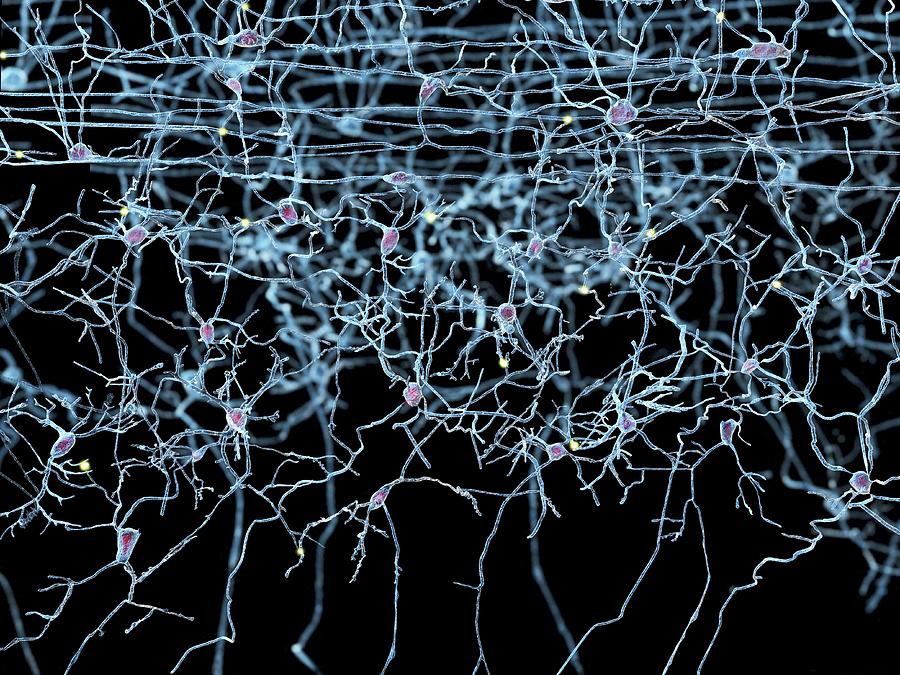 Nerve Cells, Artwork #1 Photograph by Juan Gaertner