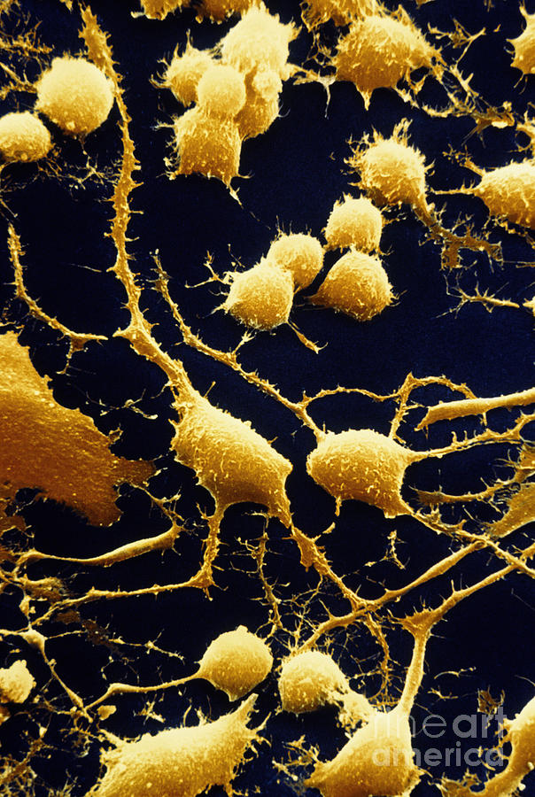 Nerve Cells #1 Photograph by David M. Phillips
