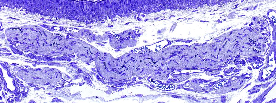 Nerve Fibre #1 Photograph by Microscape