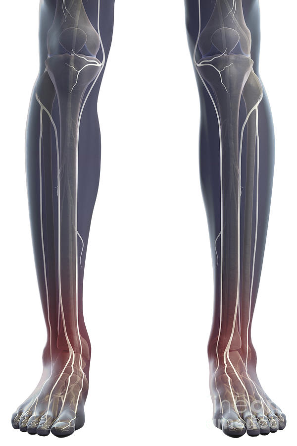 Transparent Skin Photograph - Nerves Of The Legs #1 by Science Picture Co