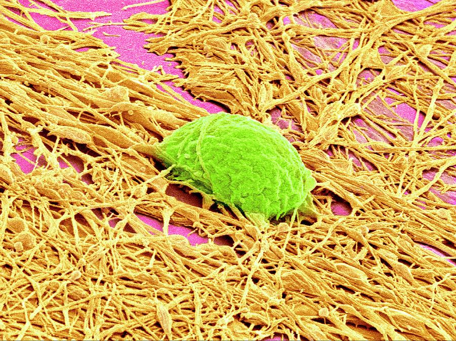Neuron Photograph - Nervous System Cells by Susumu Nishinaga Neuron Photograph - Nervous System Cells by Susumu Nishinaga