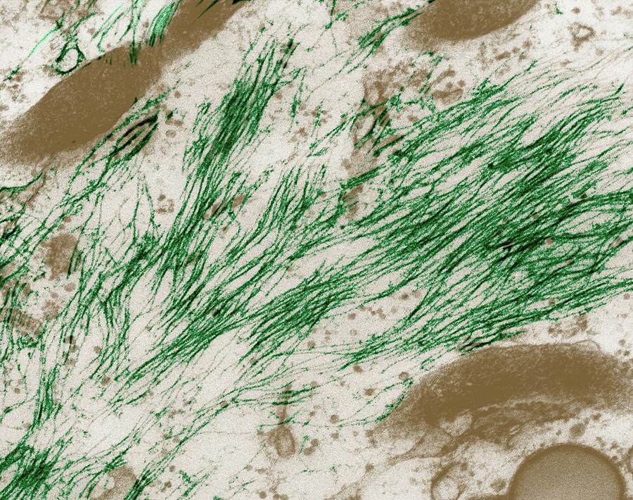 Neurofilaments In A Glial Cell 1 By Dennis Kunkel Microscopyscience Photo Library 6072