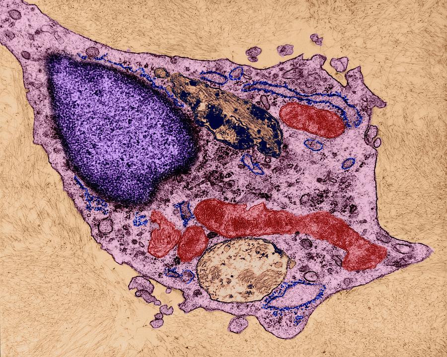 Neuroglia Cell Destroying Betaamyloid #1 Photograph by Dennis Kunkel Microscopy/science Photo Library