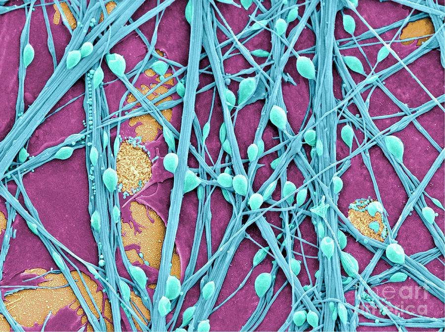 Neurons And Glial Cells, Sem #1 Photograph by Science Source