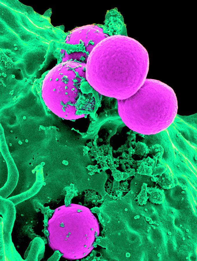 Neutrophil Engulfing Mrsa #1 Photograph by National Institute Of Allergy And Infectious Diseases (niaid)/national Institutes Of Health