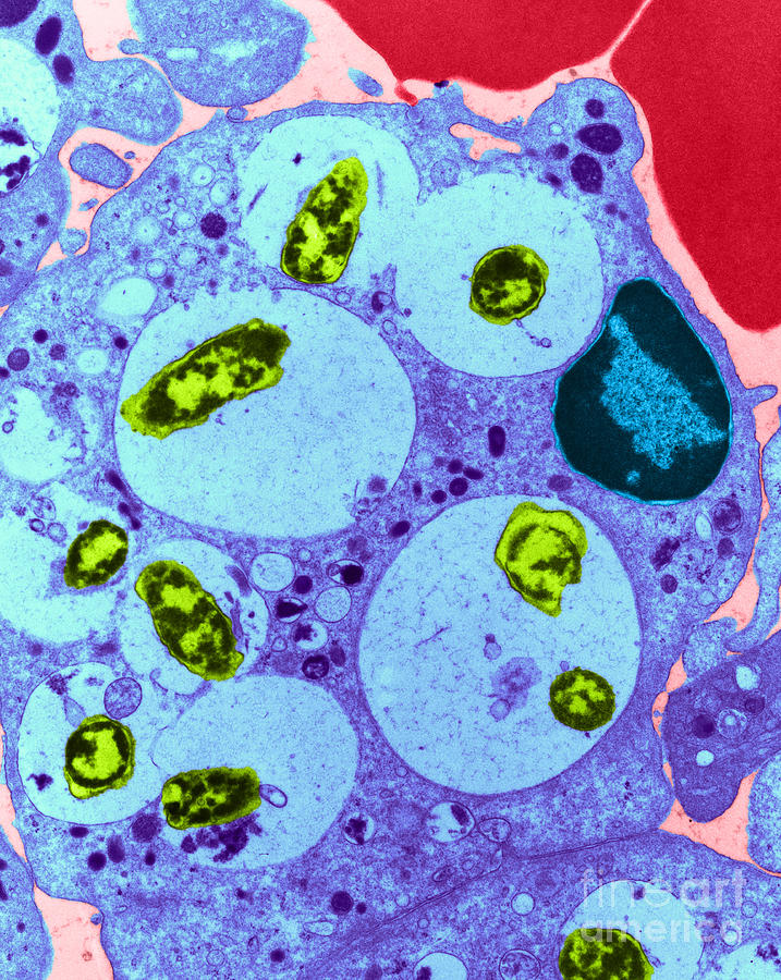 Science Photograph - Neutrophil Ingesting Bacteria Tem #1 by David M. Phillips