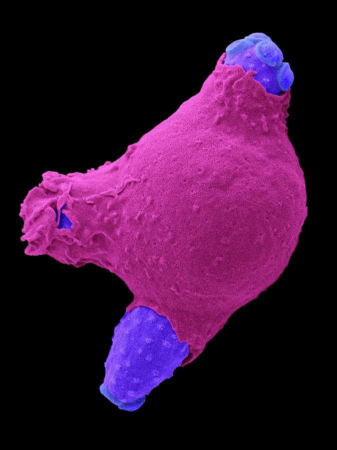 Neutrophil Phagocytosis Of Candida Photograph By Dennis Kunkel 
