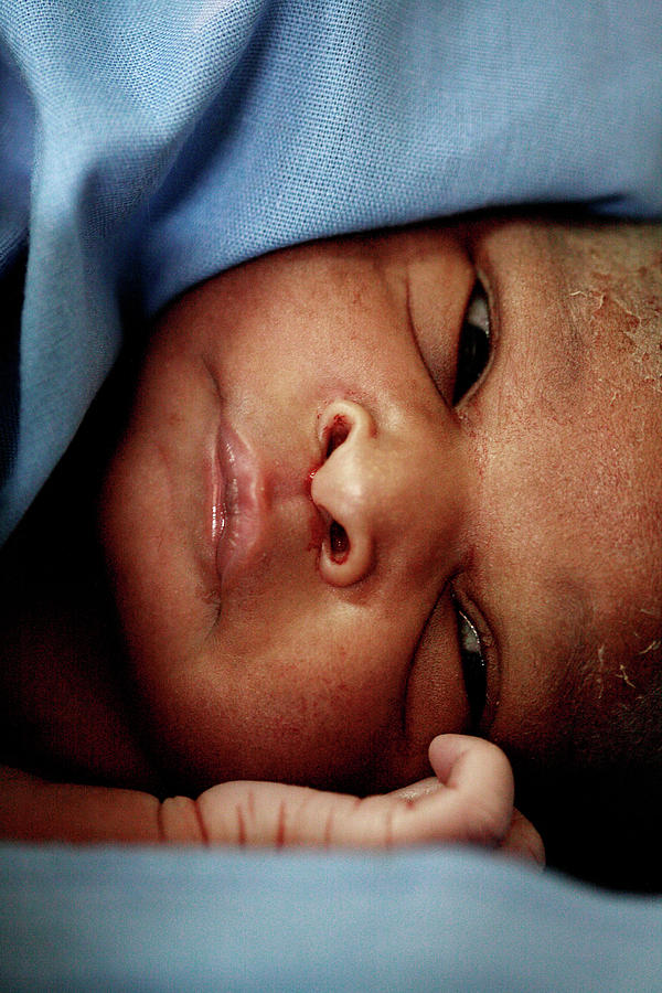 Newborn Baby After Caesarean #1 Photograph by Science Photo Library Newborn Baby After Caesarean #1 Photograph by Science Photo Library
