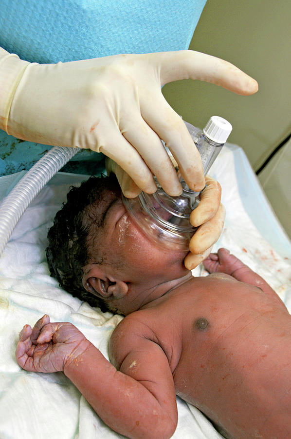 newborn oxygen mask