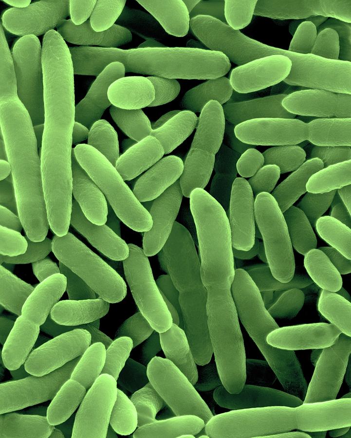 Nitrobacter Sp. Nitrifying #1 Photograph by Dennis Kunkel Microscopy