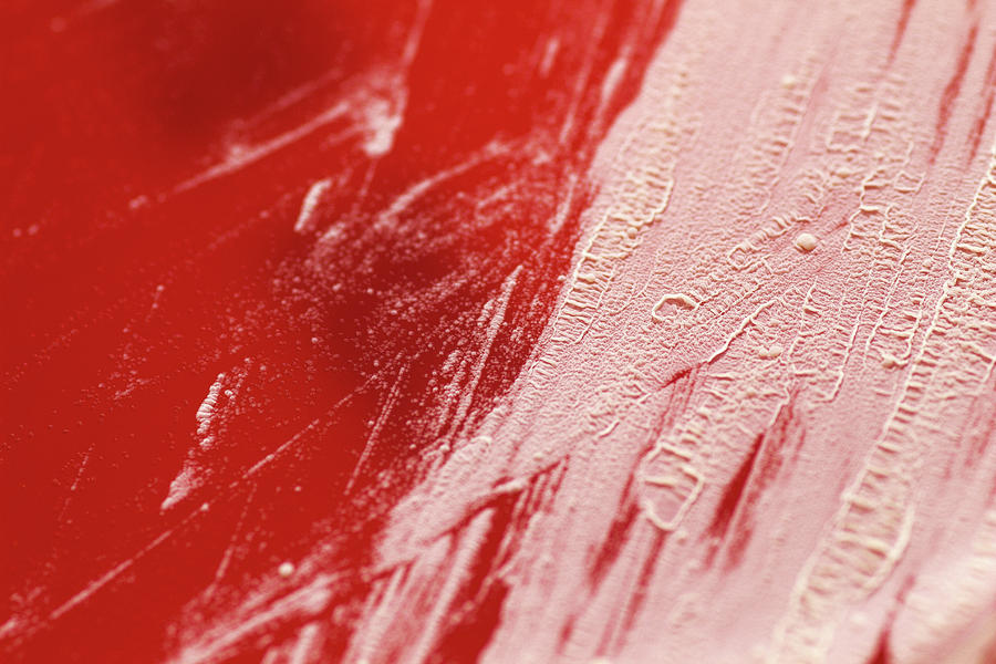 Nocardia Photograph - Nocardia Bacterial Culture by Daniela Beckmann / Science Photo Library Nocardia Photograph - Nocardia Bacterial Culture by Daniela Beckmann / Science Photo Library