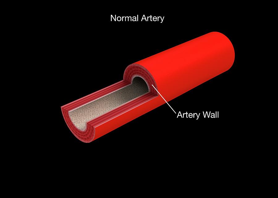 Nobody Photograph - Normal Artery Anatomy #1 by Mikkel Juul Jensen