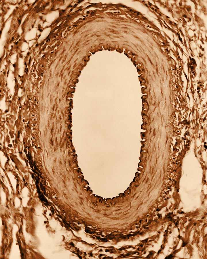 Normal Artery, Tem #1 Photograph by Omikron