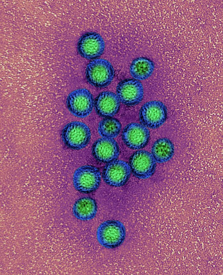 Norovirus #1 Photograph by Dennis Kunkel Microscopy/science Photo Library