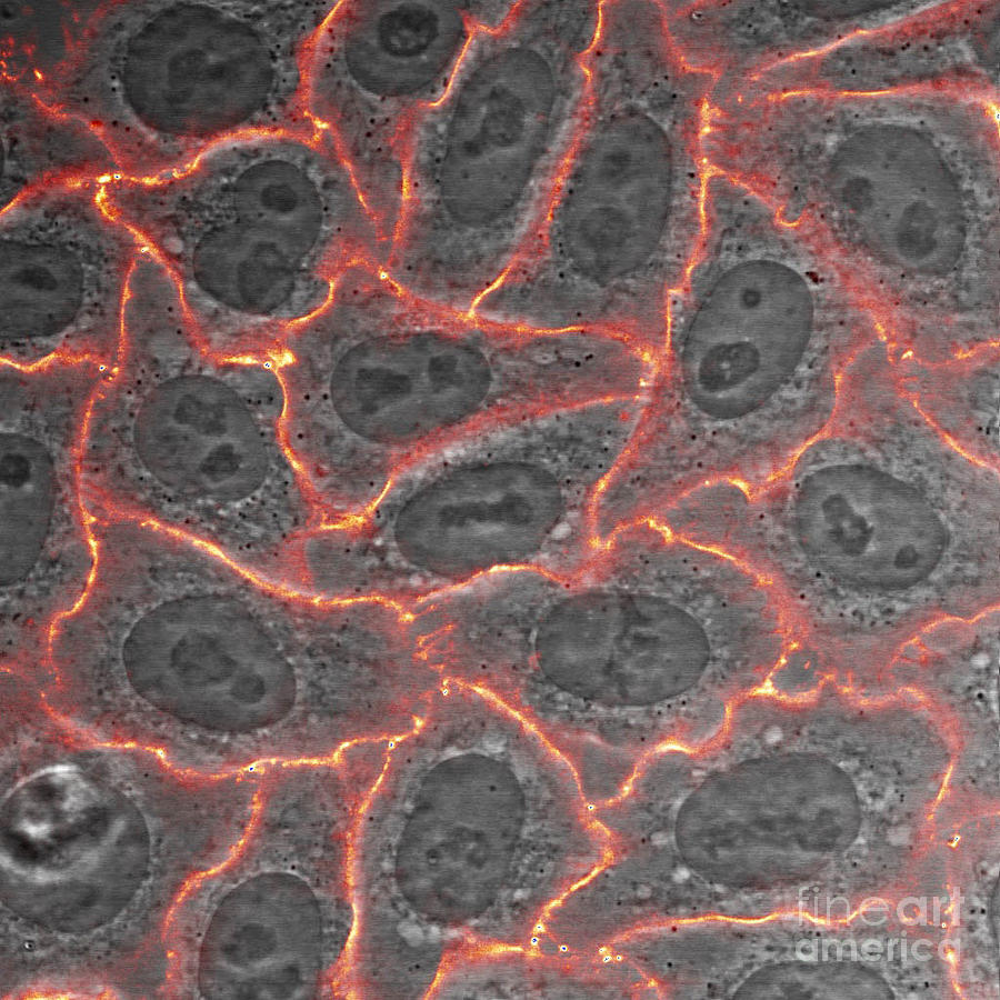 Tumor Photograph - Nucleolin Confocal Micrograph by Voisin Phanie