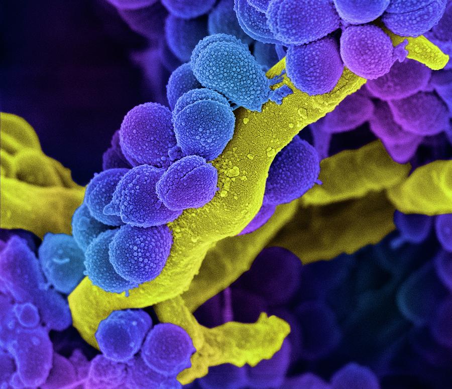 Streptococcus Photograph - Oral Streptococcus Bacteria #1 by Science Photo Library
