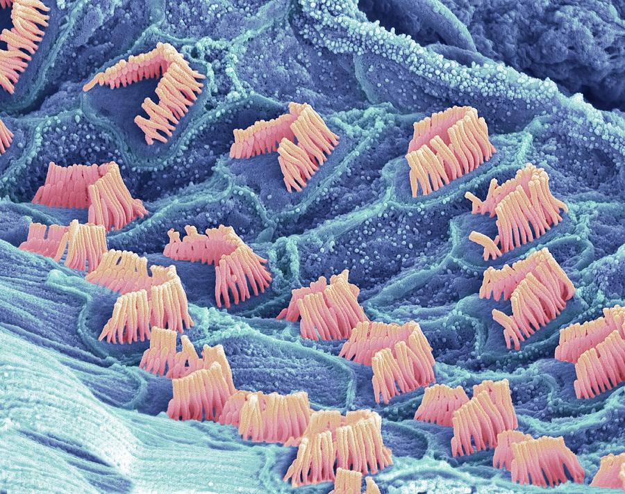 Ощущение клетки. Волосковые клетки микрофотография. Волосковые клетки под микроскопом. Волосковые клетки под электронным микроскопом:. Волосковые клетки внутреннего уха микрофотография.