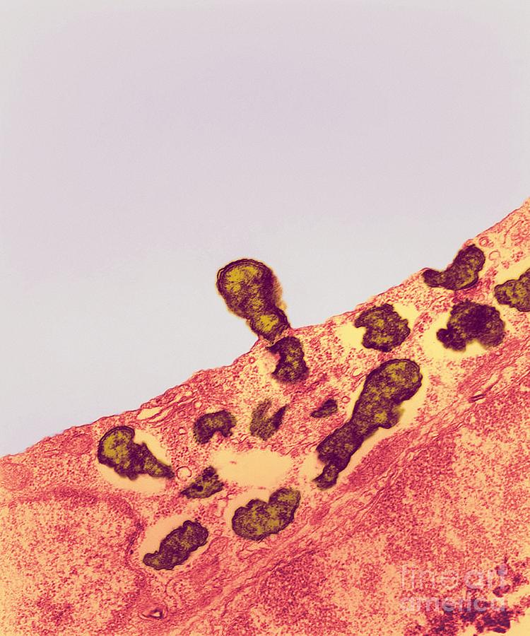 Abnormal Photograph - Orientia Tsutsugamushi Bacteria Infection #1 by Ami Images