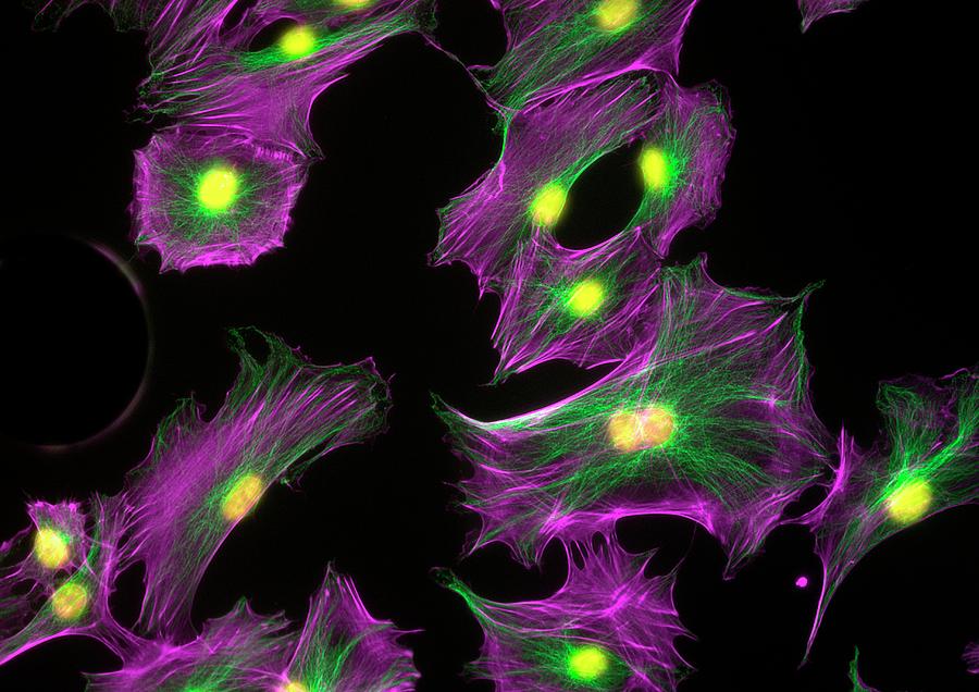 Osteoblast Cells Photograph by Kevin Mackenzie / University Of Aberdeen ...