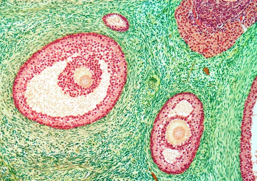 Ovarian Follicles #1 Photograph by Steve Gschmeissner/science Photo Library