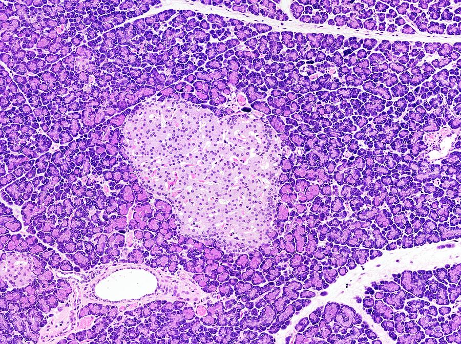 Pancreas #1 Photograph by Microscape