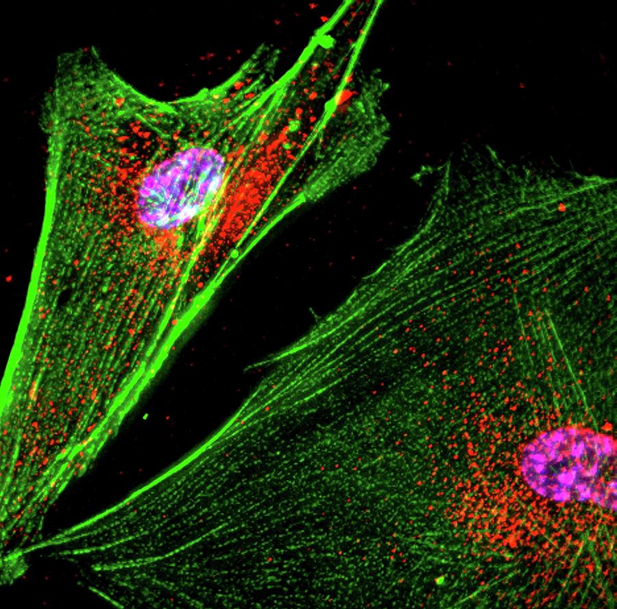 Parkinsons Disease Research #1 Photograph by R. Bick, B. Poindexter, Ut Medical School/science Photo Library