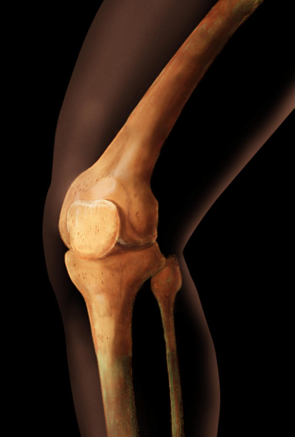 Patella And Knee #1 Photograph by Anatomical Travelogue