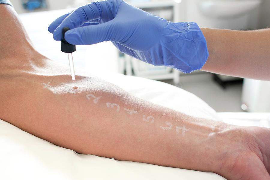 Patient Undergoing A Skin Prick Test Photograph By Science Photo Library Pixels