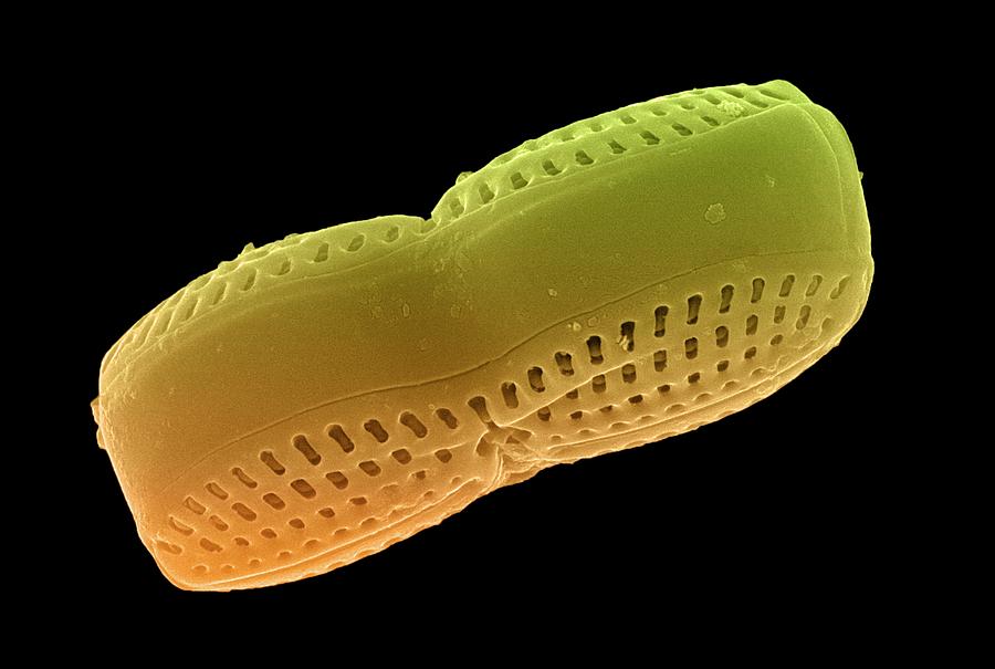 Pennate Diatom #1 Photograph by Ami Images