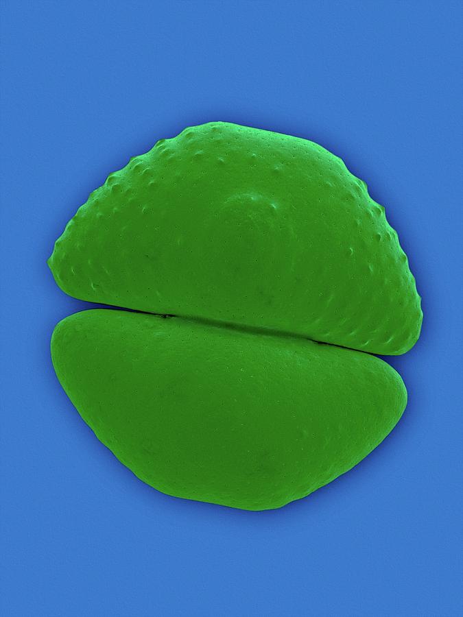 Placoderm Desmid (cosmarium Botrytis) #1 Photograph by Dennis Kunkel Microscopy/science Photo Library