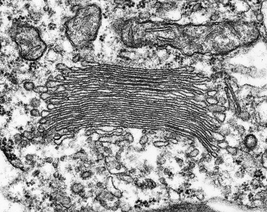 Plant (alga) Golgi Apparatus #1 Photograph by Dennis Kunkel Microscopy/science Photo Library