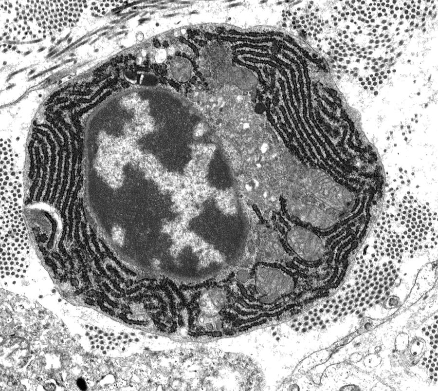 Antigens Photograph - Plasma Cell by Steve Gschmeissner/science Photo Library Antigens Photograph - Plasma Cell by Steve Gschmeissner/science Photo Library