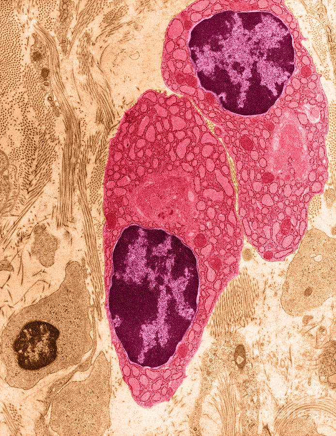 Plasma Cells Tem Photograph by David M. Phillips - Fine Art America