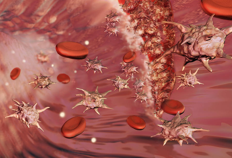 Platelets, Illustration #1 Photograph by Spencer Sutton