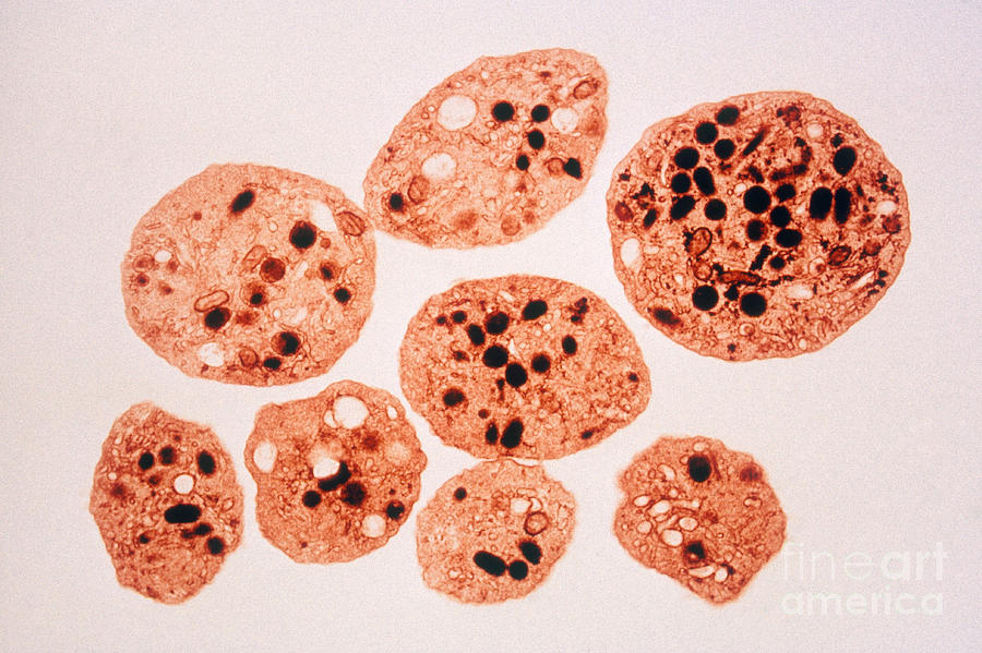 Platelets, Tem #1 Photograph by Scott Camazine