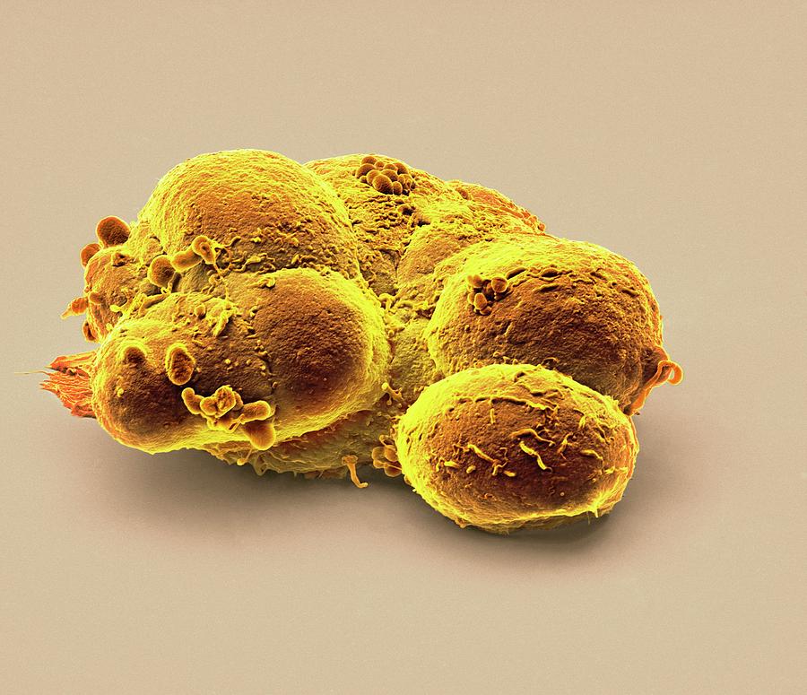 Pluripotent Stem Cells #1 Photograph by Steve Gschmeissner