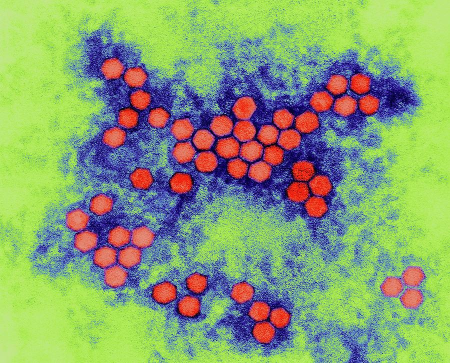 Polio Virus #1 Photograph by Dennis Kunkel Microscopy/science Photo Library