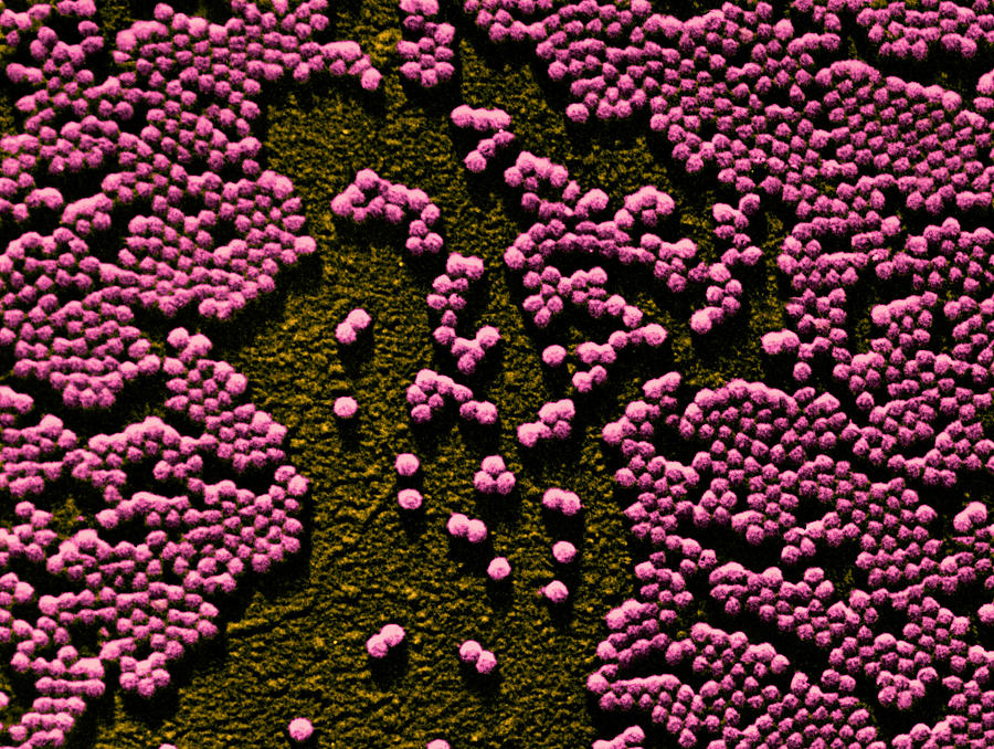 Polio Virus, Tem #1 Photograph by Omikron