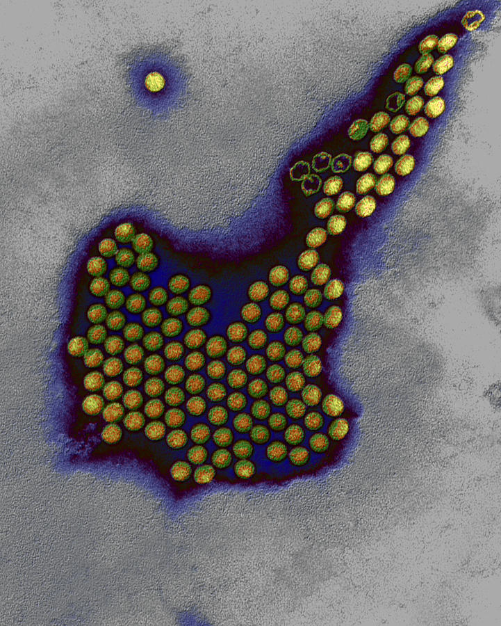 Polio Viruses #1 Photograph by Eye of Science